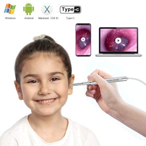 Teslong Ultra-Slim Digital Otoscope | ear wax remover as seen on tv | ear wax remover walmart