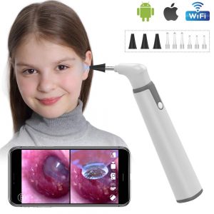 Wireless Otoscope Ear Camera with Dual View | ear wax remover walmart